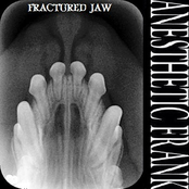 Fractured Jaw EP