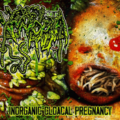 Inorganic Cloacal Pregnancy