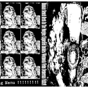 Human Stench Rests In The Morgue / Liquified Insides / Wormosis / Fetus Demersus / Nosocomial Renal Myiasis