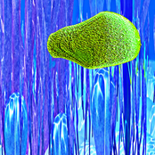 Acadoparadoxides Mureroensis