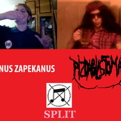 PIZOBLASTOMA!\ANUS ZAPEKANUS Split