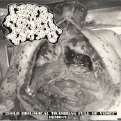 200LB Biological Trashbag Full of Vomit