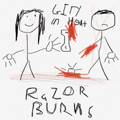 Razor Burns - Single