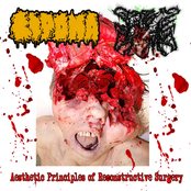 Aesthetic Principles of Recontructive Surgery