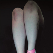 Pink Foot Bandage Volume 2