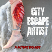 Puncture Wounds