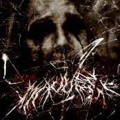 Mauled: When Your Eyes Are Shut