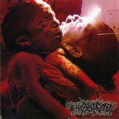 Pathologic Embryothanatology