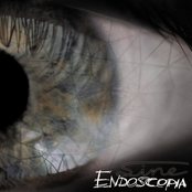 Endoscopia