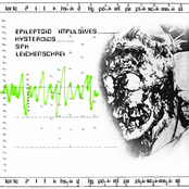 Internal Bleeding by Spk