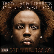 Krizz Kaliko: Vitiligo