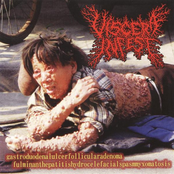 Gastroduodenalulcerfollicularadenoma Fulminanthepatitishydrocelefacialspasmmyxomatosis / Viscosas Voces Desde La Necroorgia