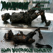 Human Spontaneous Combustion