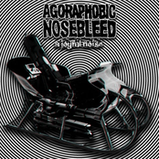 Hung Like A Stocking By The Chimney With Care by Agoraphobic Nosebleed