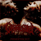 Premortem Rot