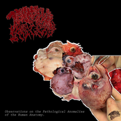 Observations On The Pathological Anomalies Of The Human Anatomy