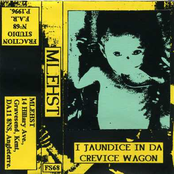 i jaundice in da crevice wagon