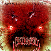 Skinned: Spawn Of Insanity