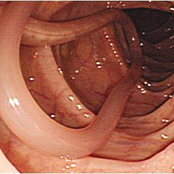 lombrigas viram anacondas