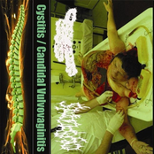 Candidal Vulvovaginitis / Cystitis