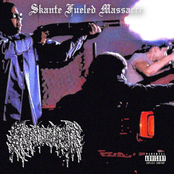 Skante Fueled Massacre