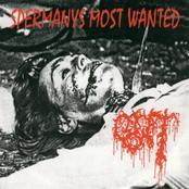 Spermanys Most Wanted