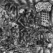 Tales of Cadaveric Dismemberments