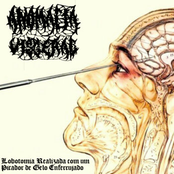 Lobotomia Realizada Com Um Picador De Gelo Enferrujado