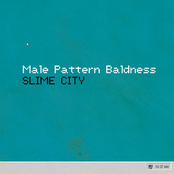 Male Pattern Baldness