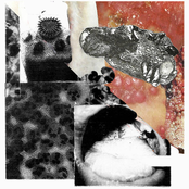 Hemorrhagic Pyrexia Virus / Gonococcus