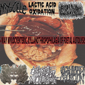 6-Way Mylocyenteric-Xyllanothropophilagia Of Foetal Autolysis