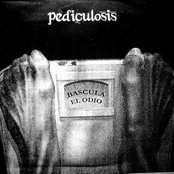 Pediculosis