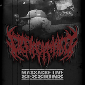 Massacre Live Sessions