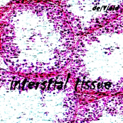 Interstial Tissue