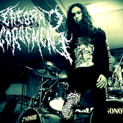 Cerebral Engorgement