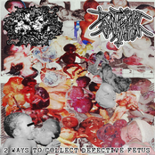 2 Ways To Collect Defective Fetus