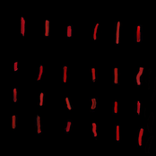 Strokes of Incarceration