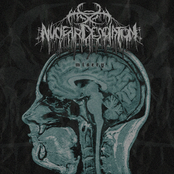 Misery - Single
