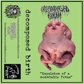 Expulsion of a nonviable fetus