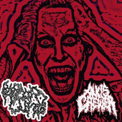 Popcorn Lung / Anus Chewer