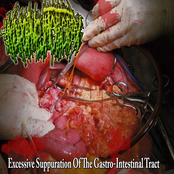 Excessive Suppuration Of The Gastro-Intestinal Tract