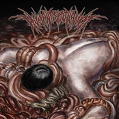 Dissevered Genitals by Human Repugnance