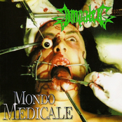 Impaled: Mondo Medicale