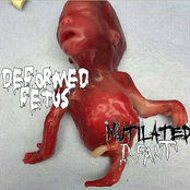 Mutilated Infant / Deformed Fetus