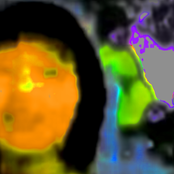 Life at the bottom of the well.