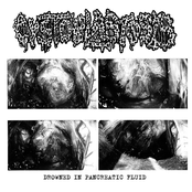 Drowned In Pancreatic Fluid (Demo)