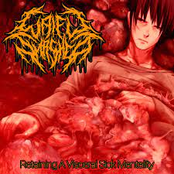 Retaining a Visceral Sick Mentality