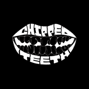 Chipped Teeth
