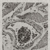 Spread it like sickness