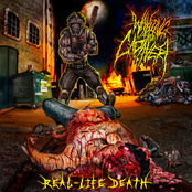 Walking the Cadaver: Real-Life Death